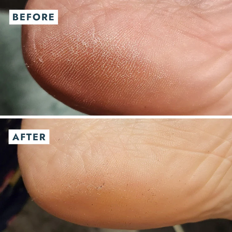 VOESH Heel Repair Duo - Repair Balm + Heel Socks - Image 6