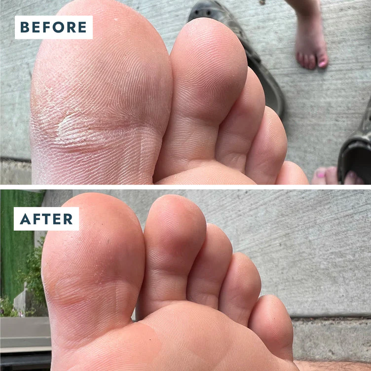 VOESH Heel Repair Duo - Repair Balm + Heel Socks - Image 7